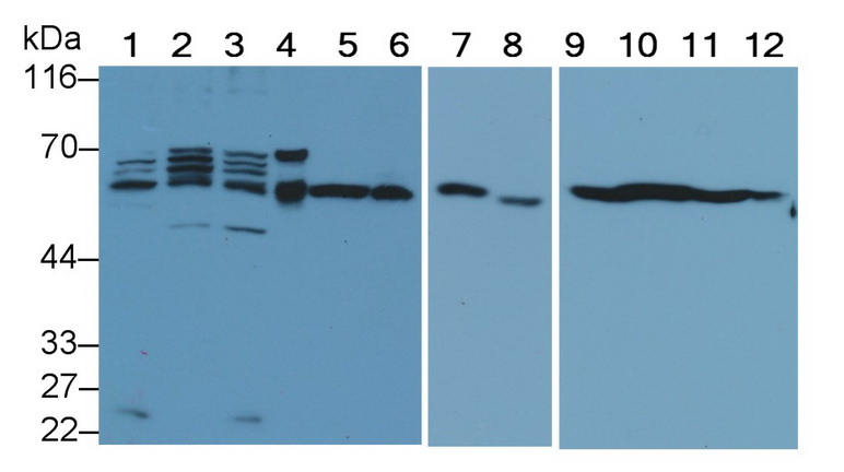 Monoclonal Antibody to Beclin 1 (BECN1)