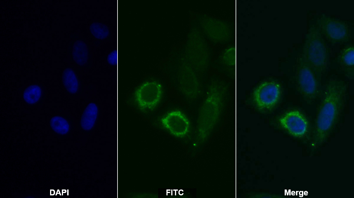 Monoclonal Antibody to Succinate Dehydrogenase Complex Subunit A (SDHA)