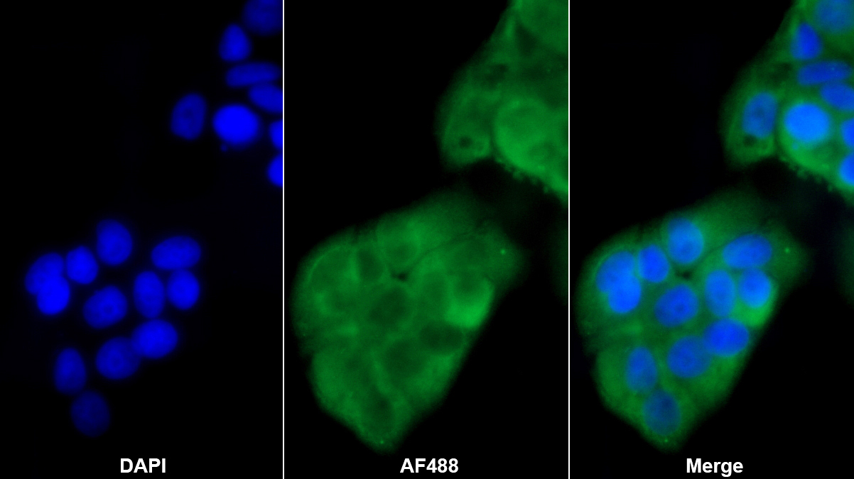 Monoclonal Antibody to Tyrosine 3/Tryptophan 5 Monooxygenase Activation Protein Zeta (YWHAz)