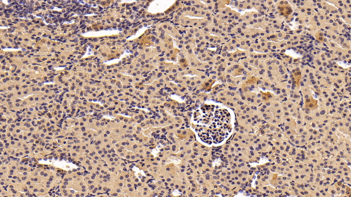 Monoclonal Antibody to Tyrosine 3/Tryptophan 5 Monooxygenase Activation Protein Zeta (YWHAz)