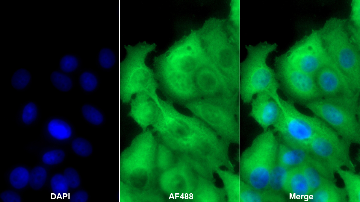 Monoclonal Antibody to Tyrosine 3/Tryptophan 5 Monooxygenase Activation Protein Zeta (YWHAz)
