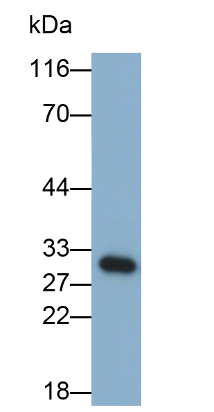 Monoclonal Antibody to Snail Homolog 1 (SNAI1)