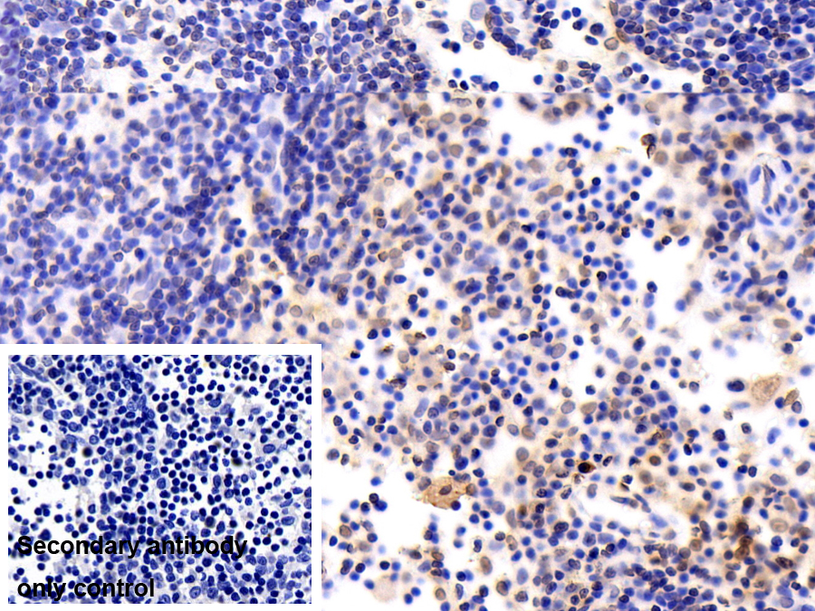 Monoclonal Antibody to Snail Homolog 1 (SNAI1)