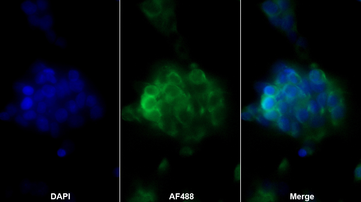 Monoclonal Antibody to Wolfram Syndrome Protein 1 (WFS1)