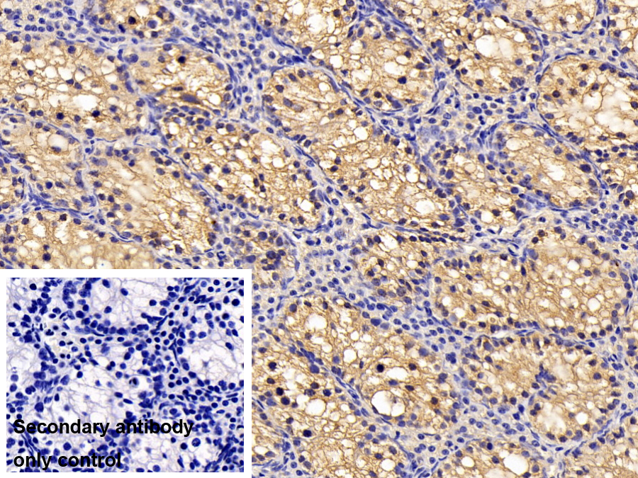 Monoclonal Antibody to Chaperonin Containing TCP1, Subunit 2 (CCT2)