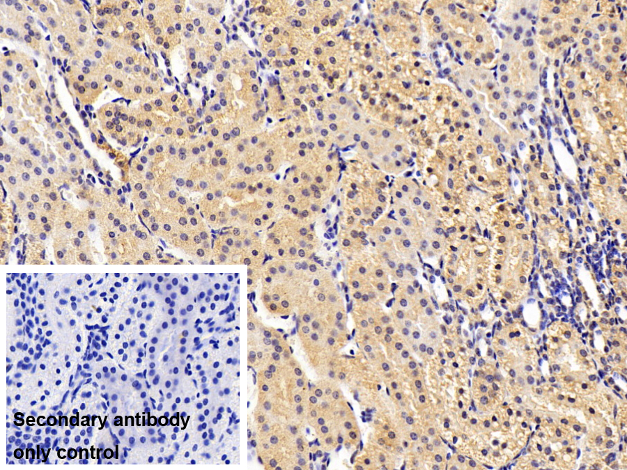Monoclonal Antibody to Chaperonin Containing TCP1, Subunit 2 (CCT2)