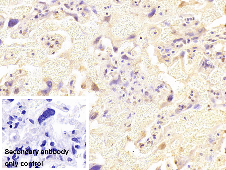 Monoclonal Antibody to Kelch Like ECH Associated Protein 1 (KEAP1)