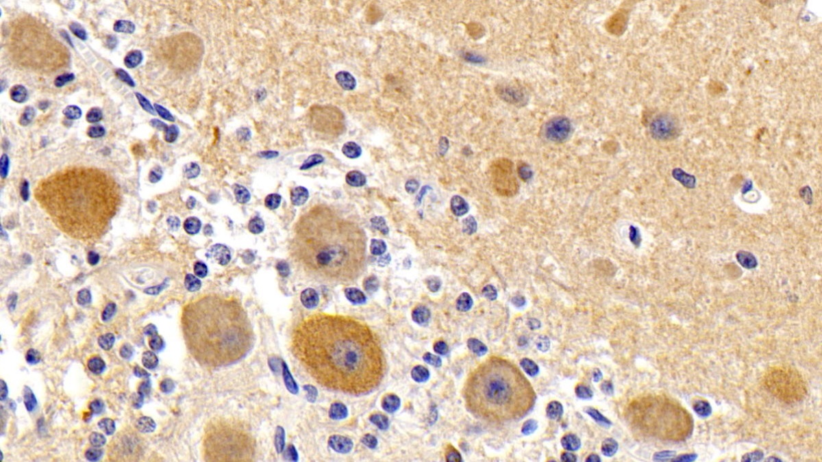 Monoclonal Antibody to Microtubule Associated Protein 1 Light Chain 3 Alpha (MAP1LC3a)