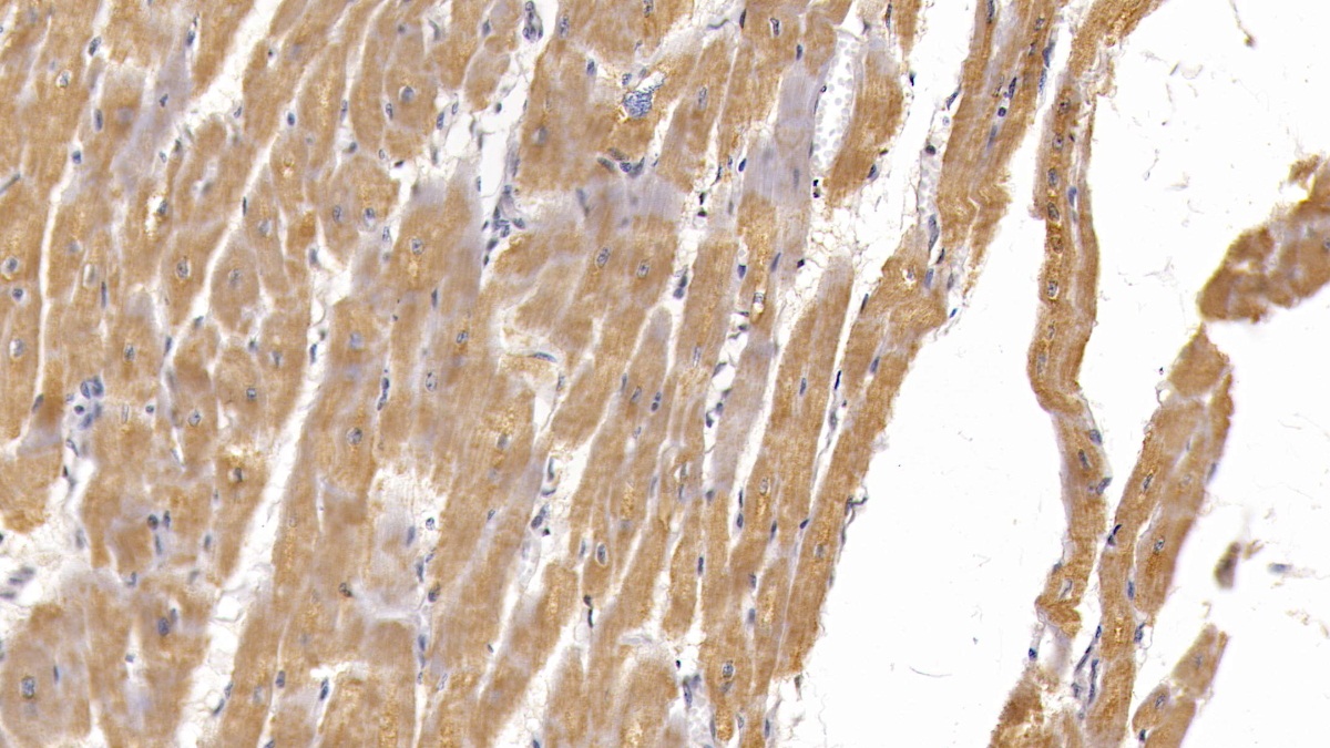 Monoclonal Antibody to Semaphorin 5B (SEMA5B)