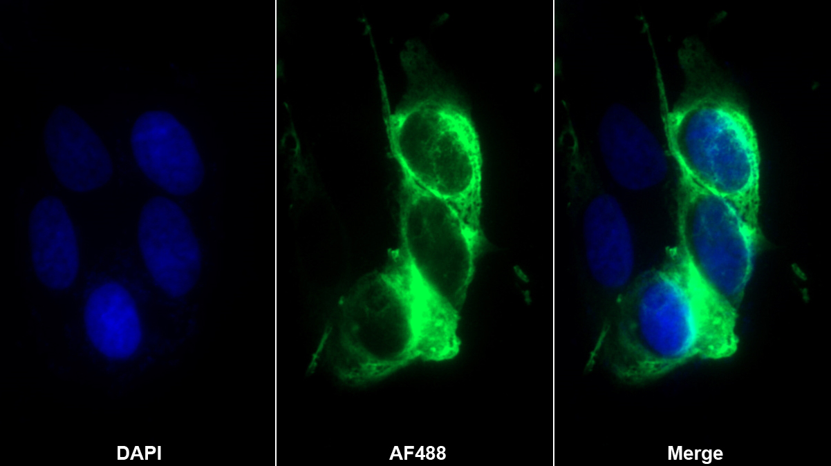 Monoclonal Antibody to Semaphorin 5B (SEMA5B)