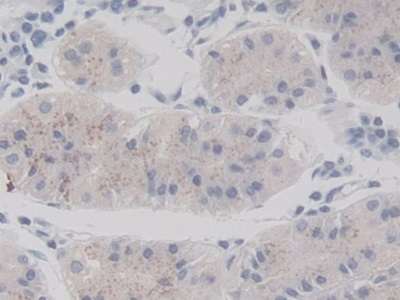 Monoclonal Antibody to V-Ral Simian Leukemia Viral Oncogene Homolog A (RALA)