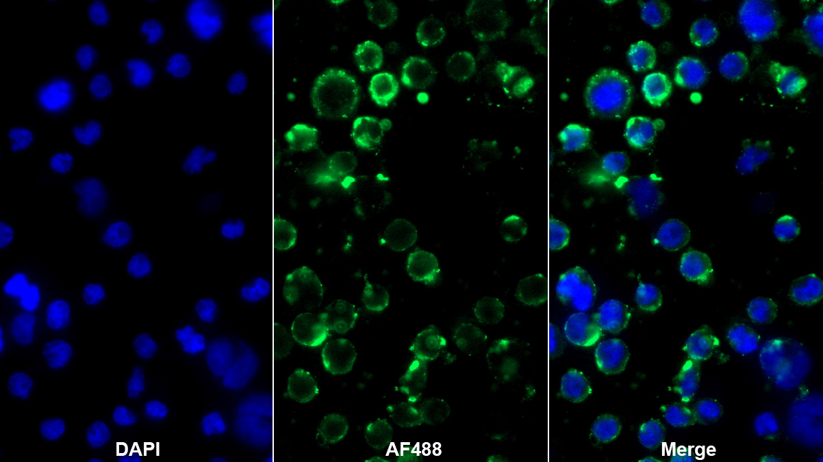 Monoclonal Antibody to T-Cell Immunoreceptor With Ig And ITIM Domains Protein (TIGIT)