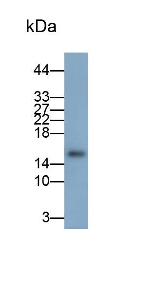 Monoclonal Antibody to Retinol Binding Protein 5, Cellular (RBP5)