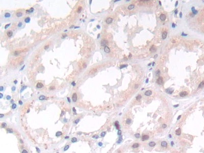 Monoclonal Antibody to Suppression Of Tumorigenicity 14 (ST14)