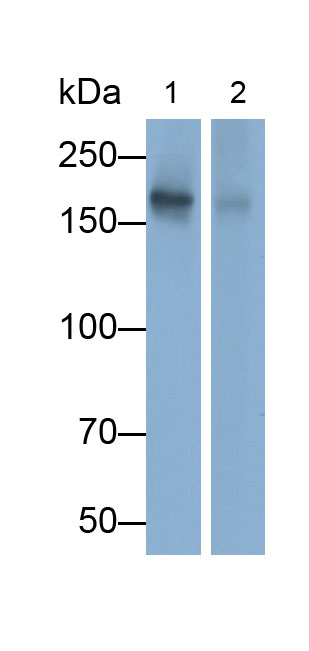 Polyclonal Antibody to Angiotensin I Converting Enzyme (ACE)