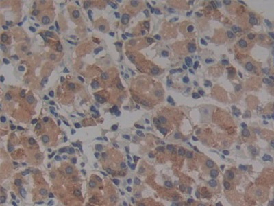 Polyclonal Antibody to Angiotensin I Converting Enzyme (ACE)