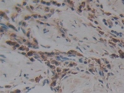 Polyclonal Antibody to Angiotensin I Converting Enzyme (ACE)