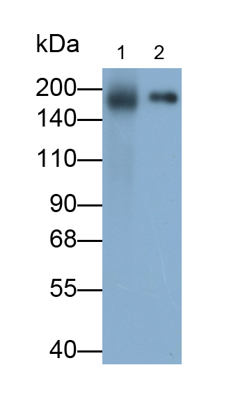 Polyclonal Antibody to Angiotensin I Converting Enzyme (ACE)