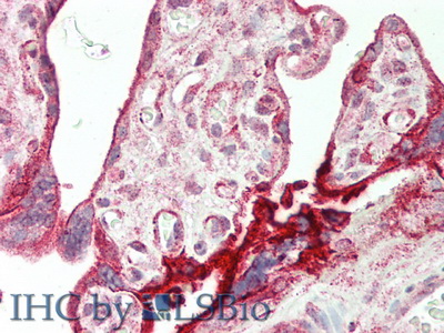 Polyclonal Antibody to Amphiregulin (AREG)