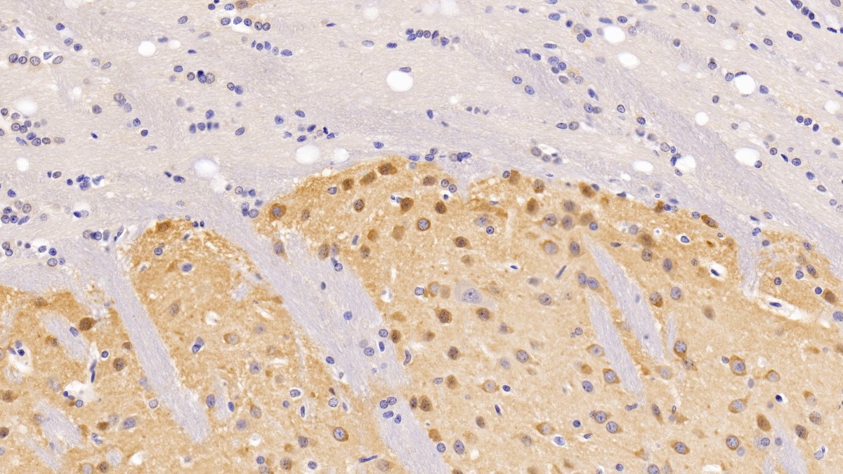 Polyclonal Antibody to Brain Derived Neurotrophic Factor (BDNF)