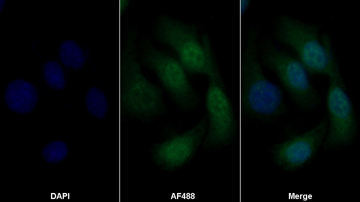 Polyclonal Antibody to Brain Derived Neurotrophic Factor (BDNF)