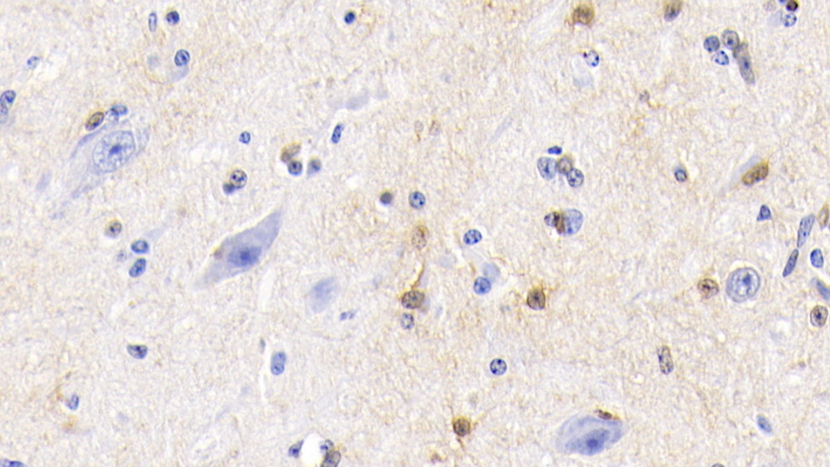 Polyclonal Antibody to S100 Calcium Binding Protein (S100)