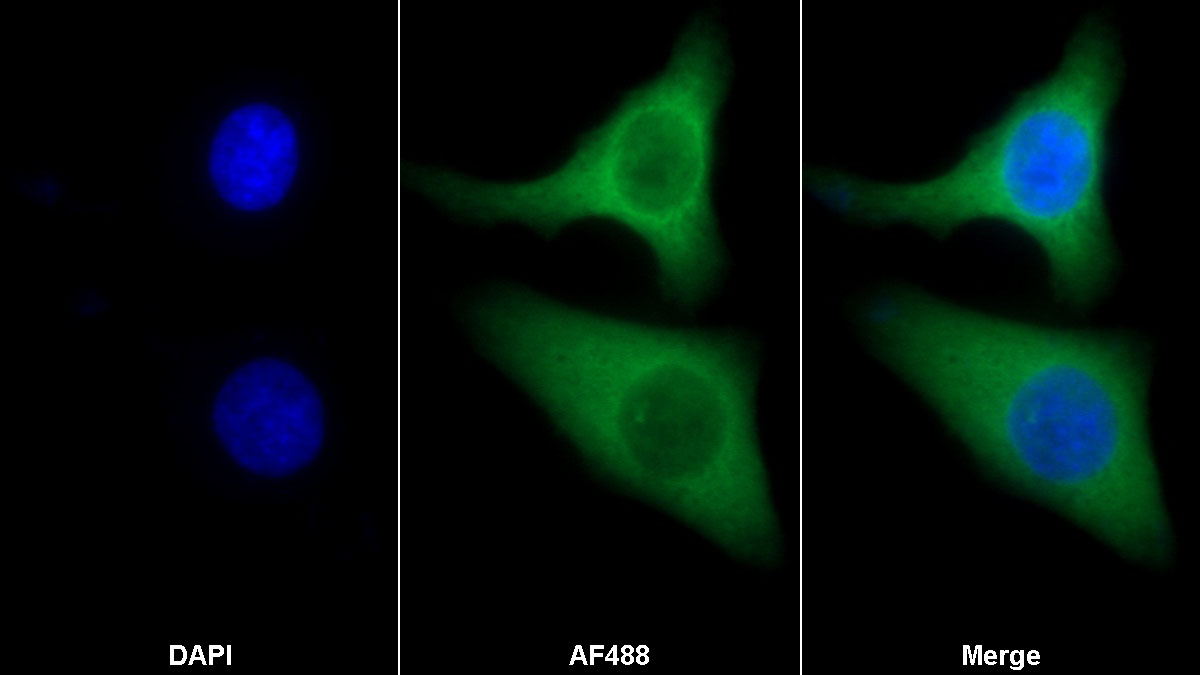 Polyclonal Antibody to S100 Calcium Binding Protein (S100)