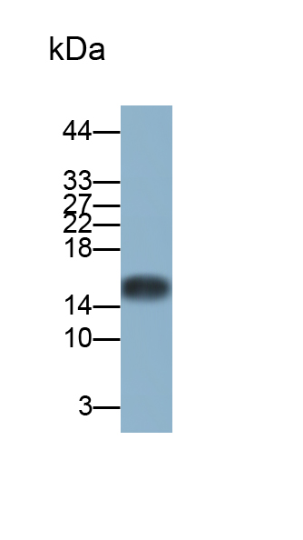 Polyclonal Antibody to S100 Calcium Binding Protein (S100)