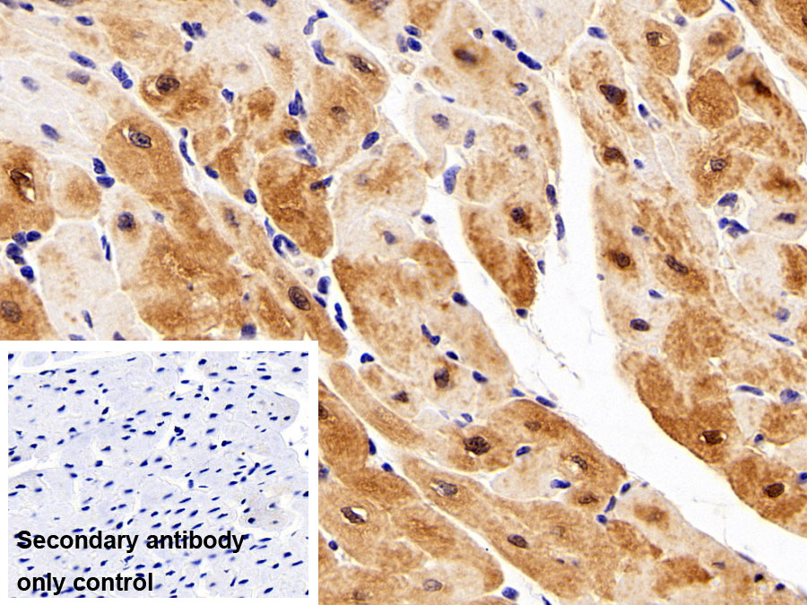 Polyclonal Antibody to S100 Calcium Binding Protein (S100)
