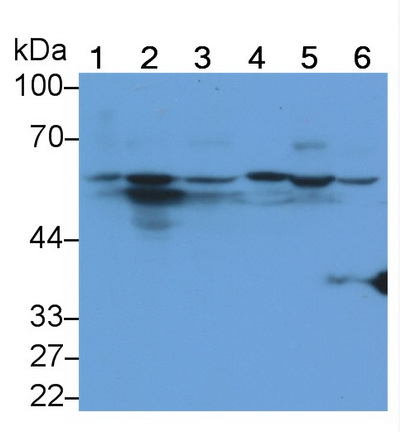 Polyclonal Antibody to Bone Morphogenetic Protein 2 (BMP2)