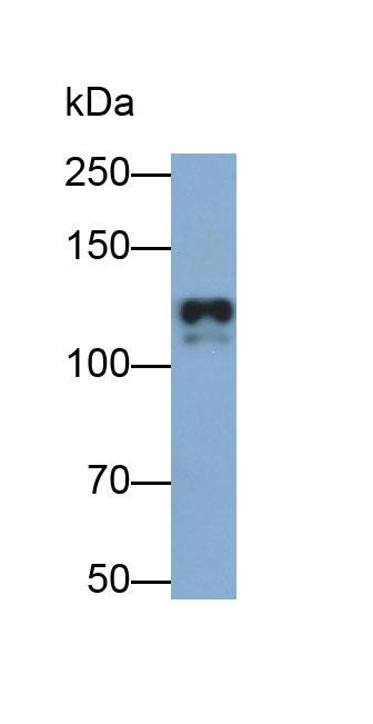 Polyclonal Antibody to E-cadherin