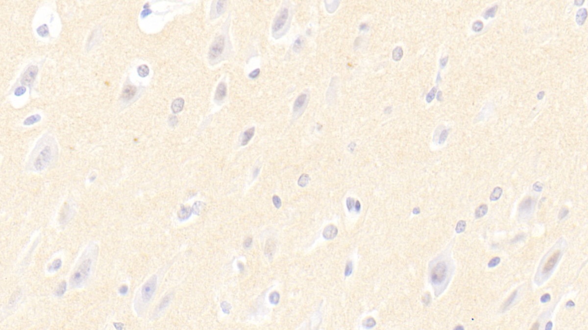 Polyclonal Antibody to Ciliary Neurotrophic Factor (CNTF)