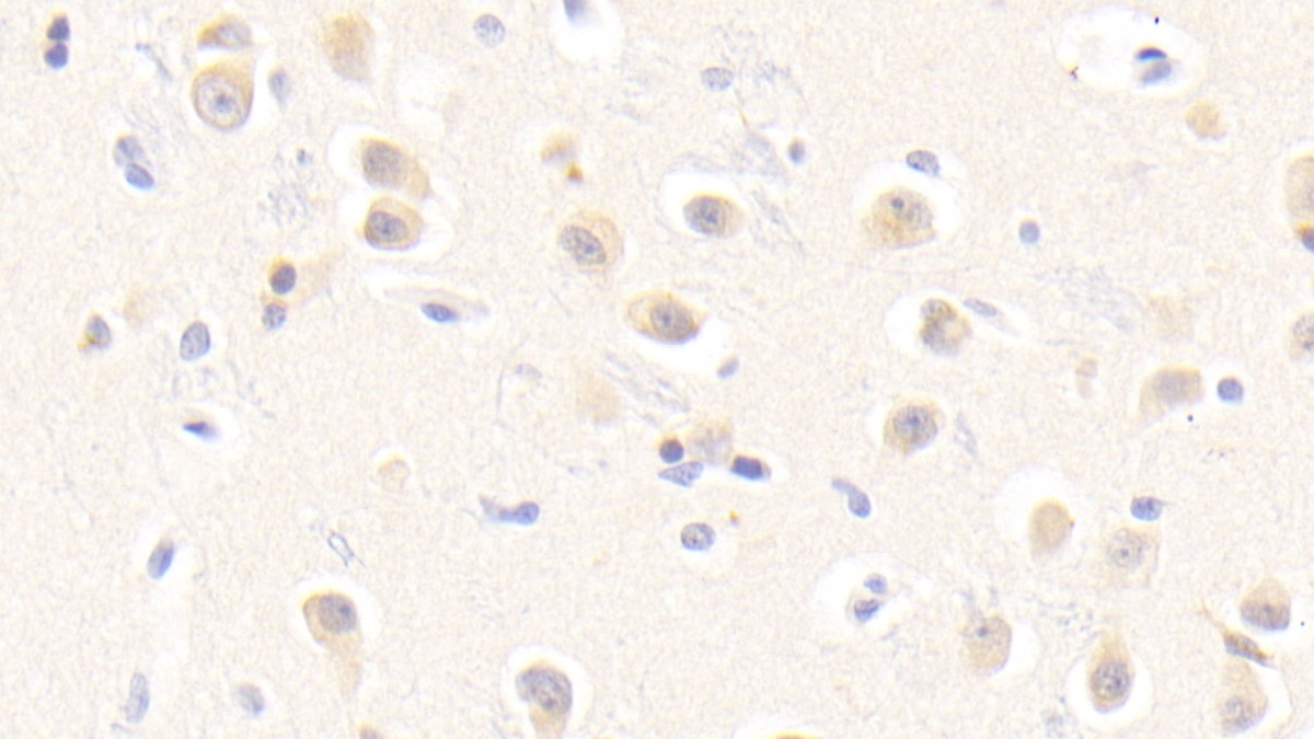 Polyclonal Antibody to Erythropoietin Receptor (EPOR)