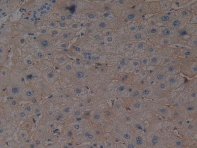 Polyclonal Antibody to Erythropoietin (EPO)