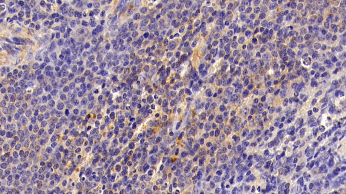 Polyclonal Antibody to Factor Related Apoptosis (FAS)