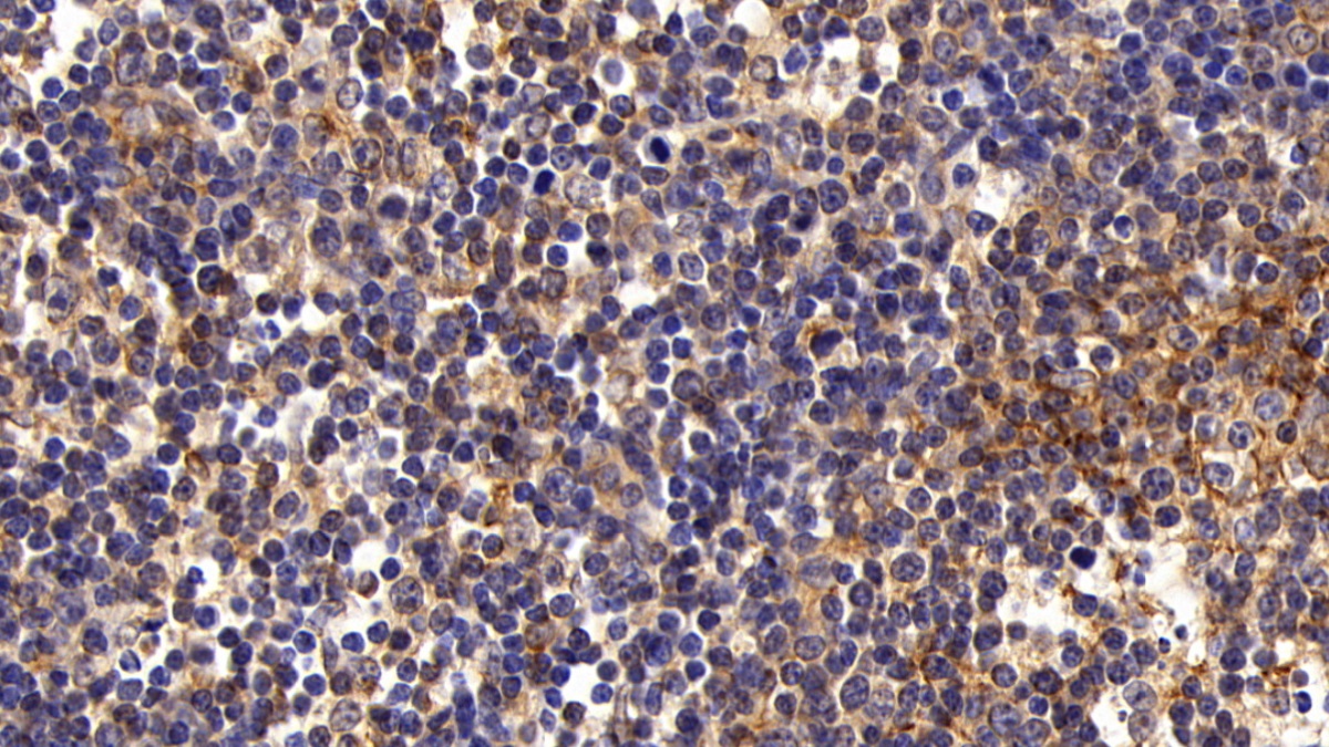 Polyclonal Antibody to Factor Related Apoptosis (FAS)