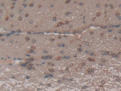 Polyclonal Antibody to Factor Related Apoptosis (FAS)