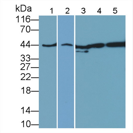 Polyclonal Antibody to Factor Related Apoptosis (FAS)