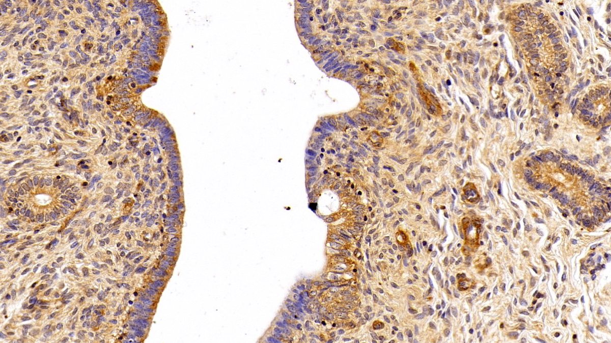 Polyclonal Antibody to Fibronectin (FN)