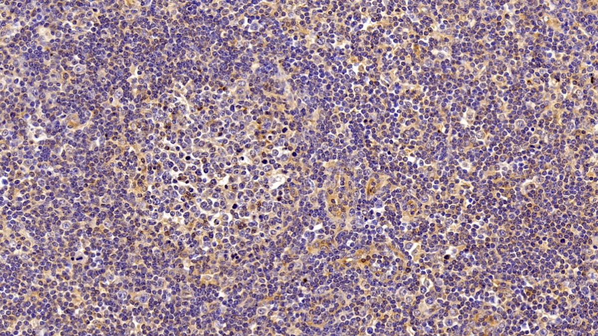 Polyclonal Antibody to Fibronectin (FN)