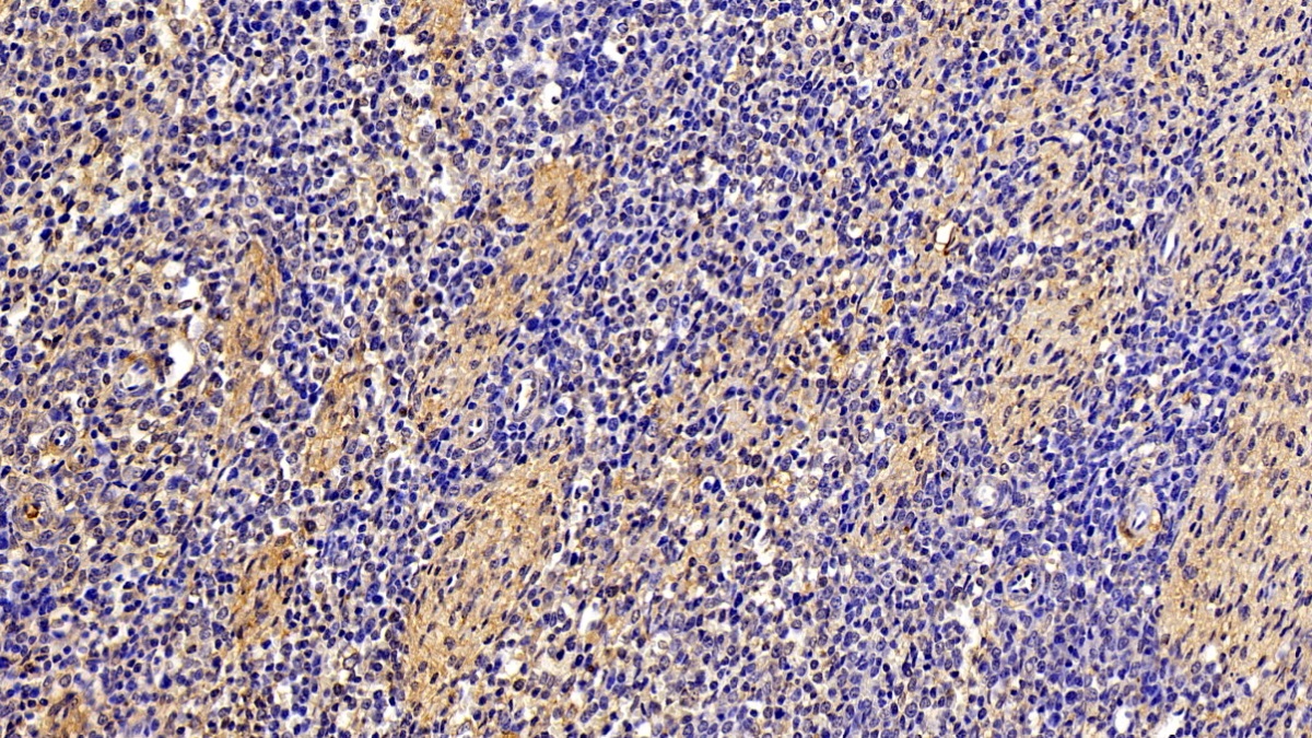 Polyclonal Antibody to Fibronectin (FN)