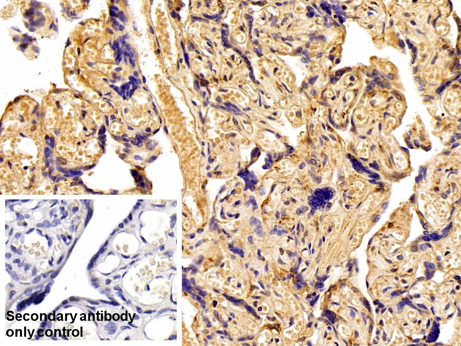 Polyclonal Antibody to Fibronectin (FN)