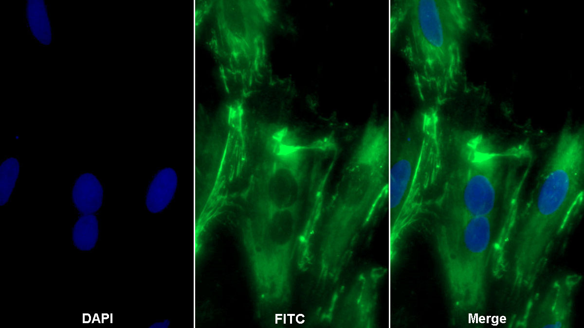 Polyclonal Antibody to Fibronectin (FN)