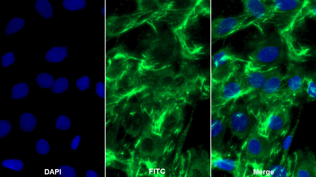 Polyclonal Antibody to Fibronectin (FN)