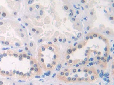 Polyclonal Antibody to Chemokine C-X3-C-Motif Ligand 1 (CX3CL1)