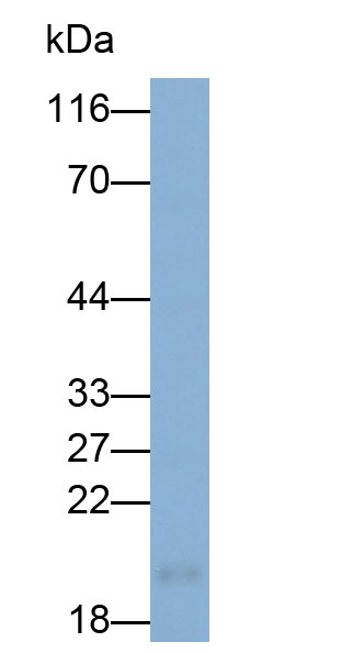 Polyclonal Antibody to Interferon Gamma (IFNg)