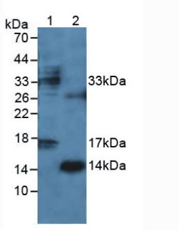 Polyclonal Antibody to Interferon Gamma (IFNg)