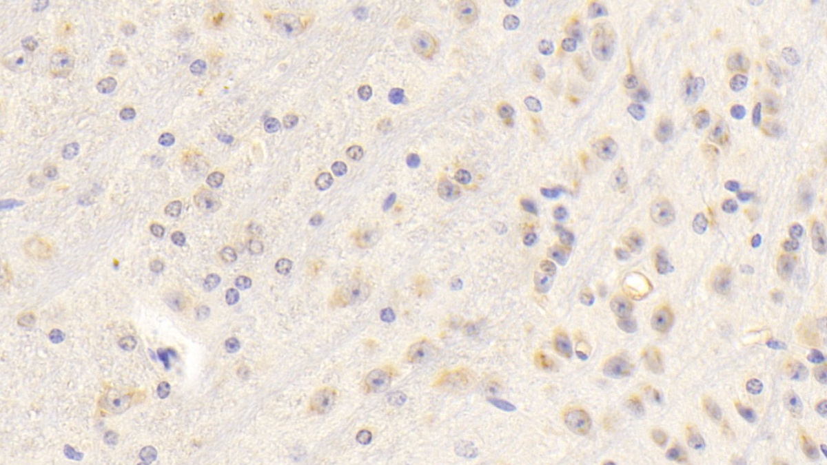 Polyclonal Antibody to Insulin Like Growth Factor 1 (IGF1)