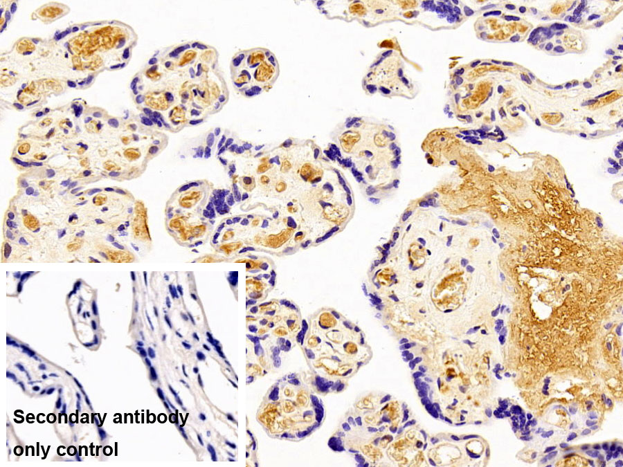 Polyclonal Antibody to Insulin Like Growth Factor 1 (IGF1)