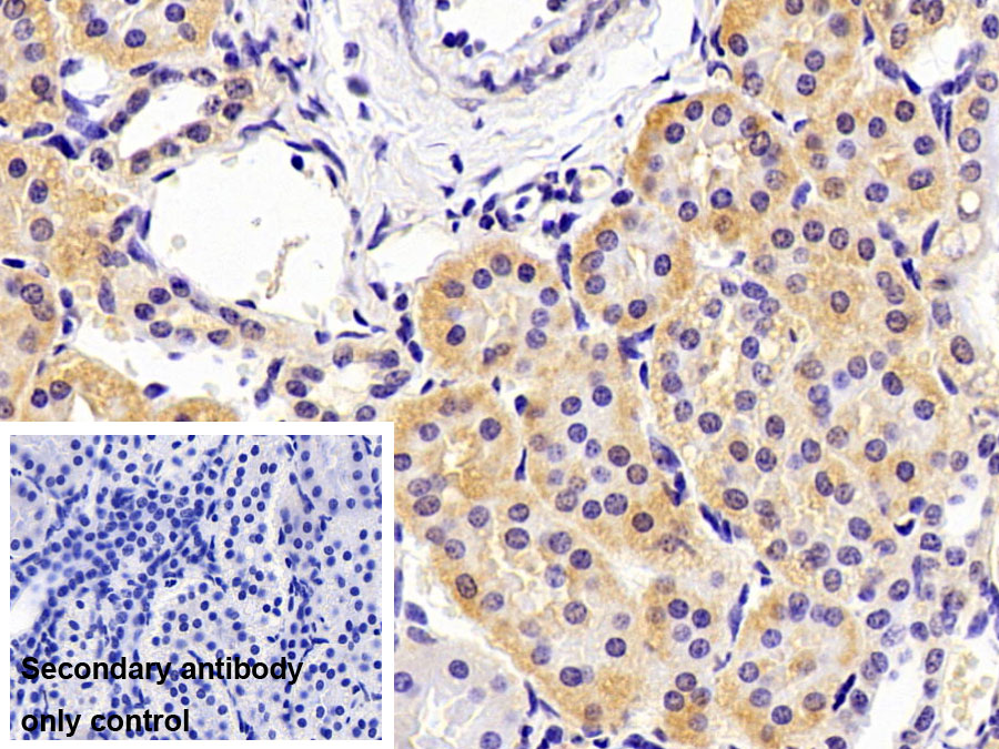 Polyclonal Antibody to Insulin Like Growth Factor 1 (IGF1)